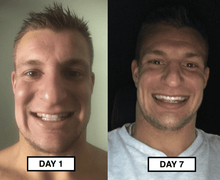 Load image into Gallery viewer, Snow® At-Home Teeth Whitening (ALL-IN-ONE KIT)