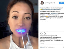 Load image into Gallery viewer, Special Offer - SNOW Teeth Whitening™ System