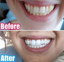 Load image into Gallery viewer, Special Offer - SNOW Teeth Whitening™ System